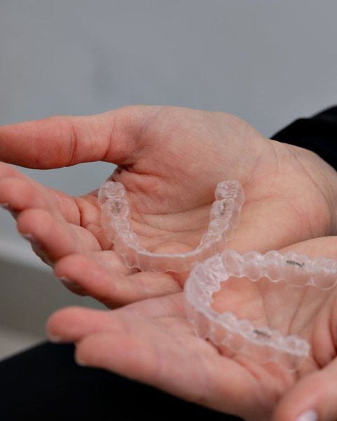 Mãos segurando dois alinhadores transparentes fora da boca